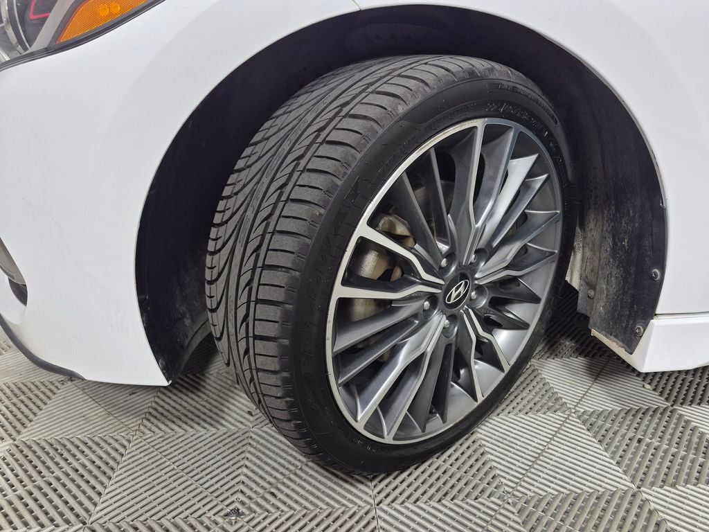 2018 Hyundai Elantra Sport